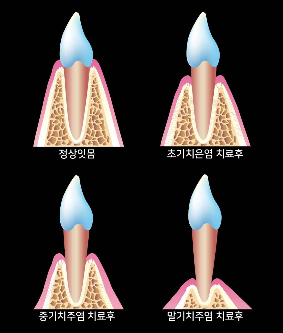 20dd8683cca1a254d1a483734f8fb4d8_1755730618_01.jpg